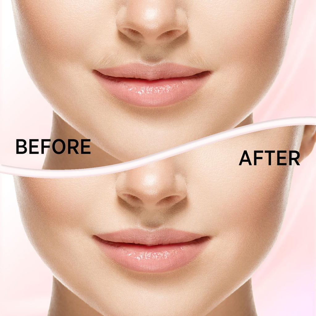 Facial Hair Removal for Women X807122